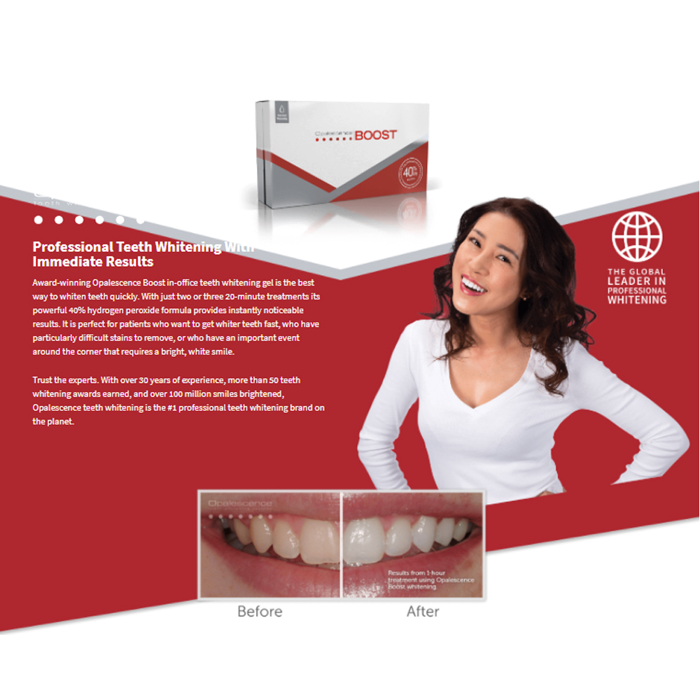 Teeth Whitening Opalescence - 오팔레센스 부스트 40% PF 아메리칸 울트라덴트