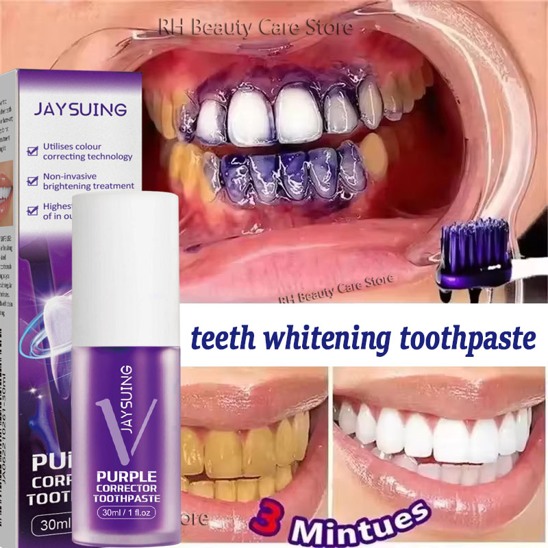 Teeth Whitening Korea - 치아 미백 치약 화이트닝 젤 화이트너