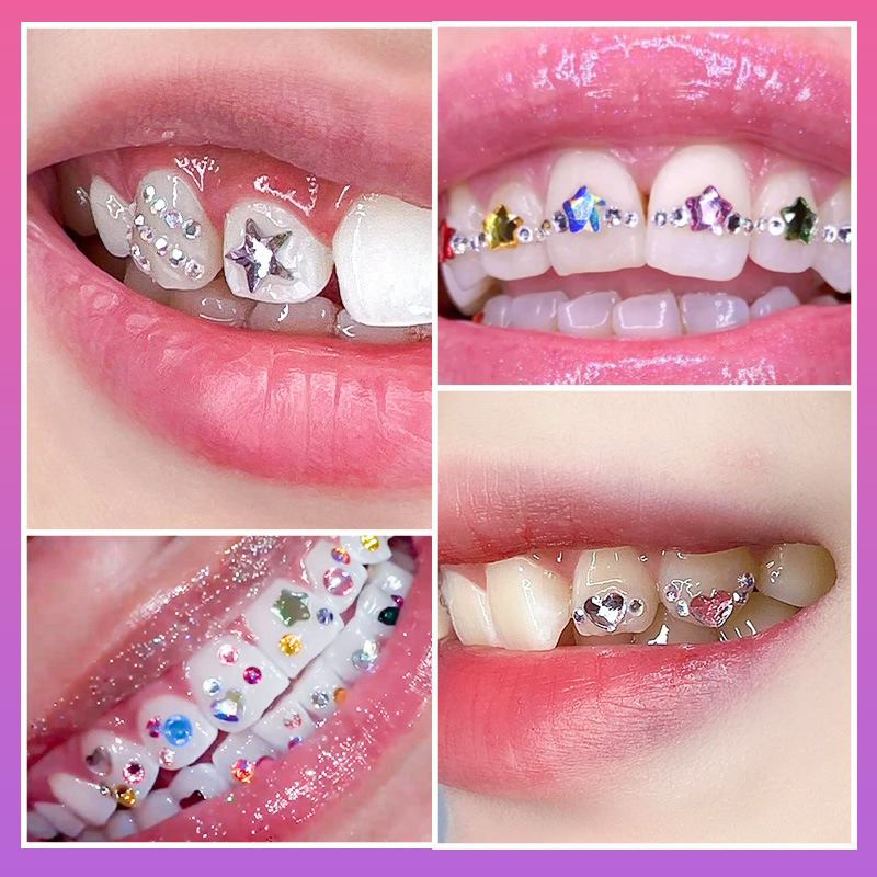 새로운 전문가용 치아 보석 키트 DIY 러브 호스 아이 - Tooth Gem Kit 리뷰 및 가격
