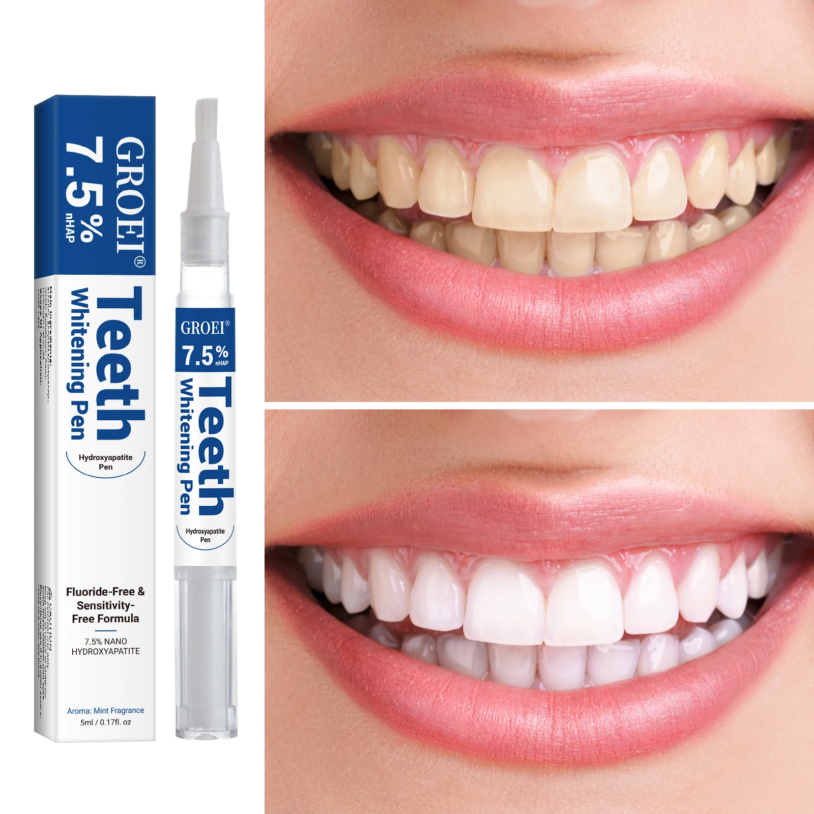 하이드록시아파타이트 치아 미백 펜 눈부신 화이트 얼룩  - Teeth Whitening Gel Peroxide 리뷰 및 가격