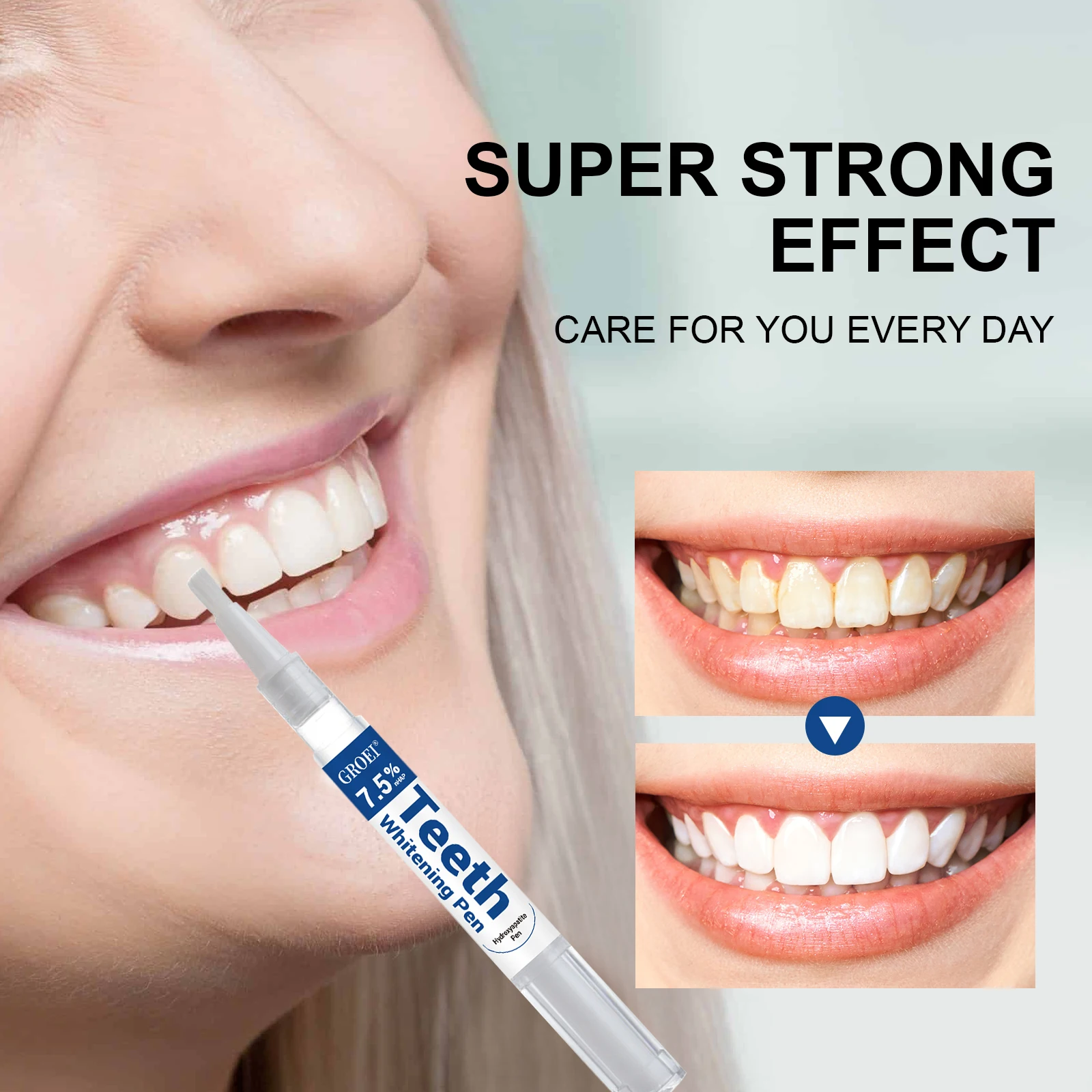 하이드록시아파타이트 치아 미백 펜 눈부신 화이트 얼룩  - Teeth Whitening Gel Peroxide 리뷰 및 가격