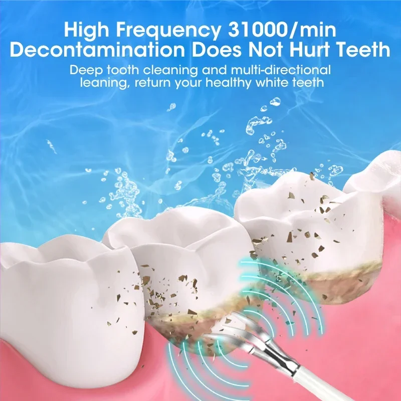 치아 세척용 초음파 스케일러 치석 제거 플라크 제거 충 - Teeth Whitening Professional 리뷰 및 가격