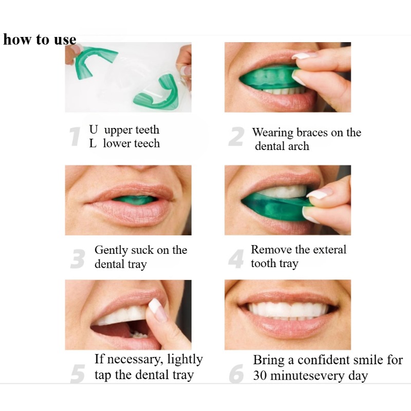 세트 치아 미백 트레이 U 자형 빠른 신선한 호흡 표백 - Teeth Whitening Opalescence 리뷰 및 가격