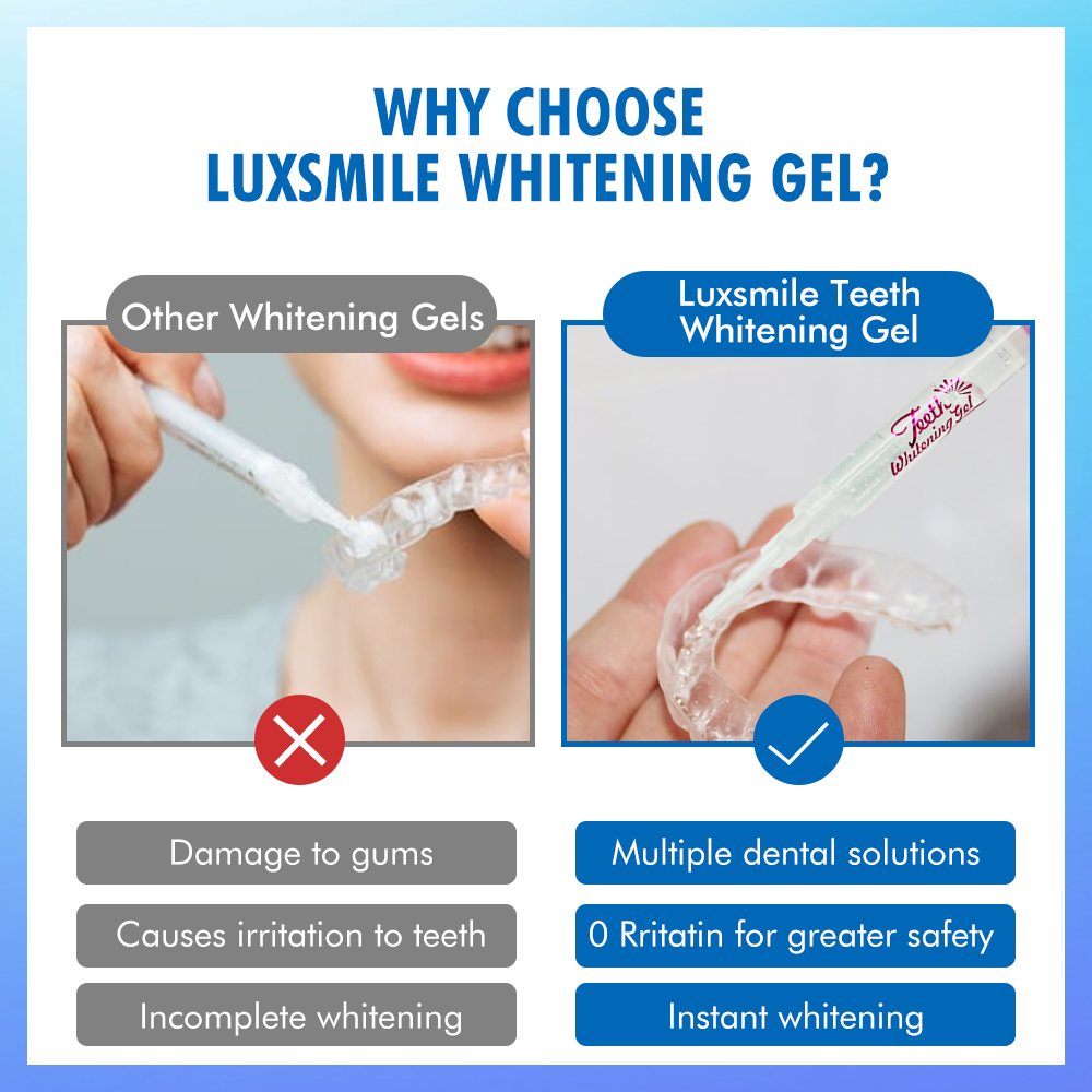 치아 미백 젤 PAP 또는 35%CP 치아 미백 젤 구 - Teeth Whitening Gel Peroxide 리뷰 및 가격