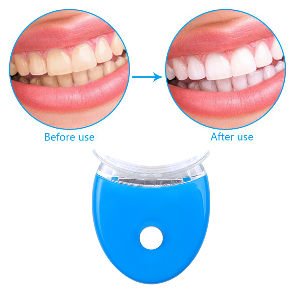 치아 미백 젤 키트 구강 위생 관리 치아 미백 도구 필 - Teeth Whitening Opalescence 리뷰 및 가격