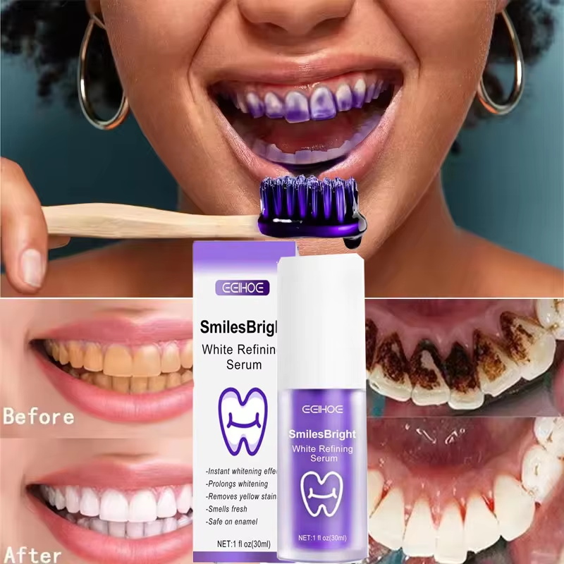 치아 미백 치약 화이트닝 젤 화이트너 표백제 얼룩 제거 - Teeth Whitening Korea 리뷰 및 가격