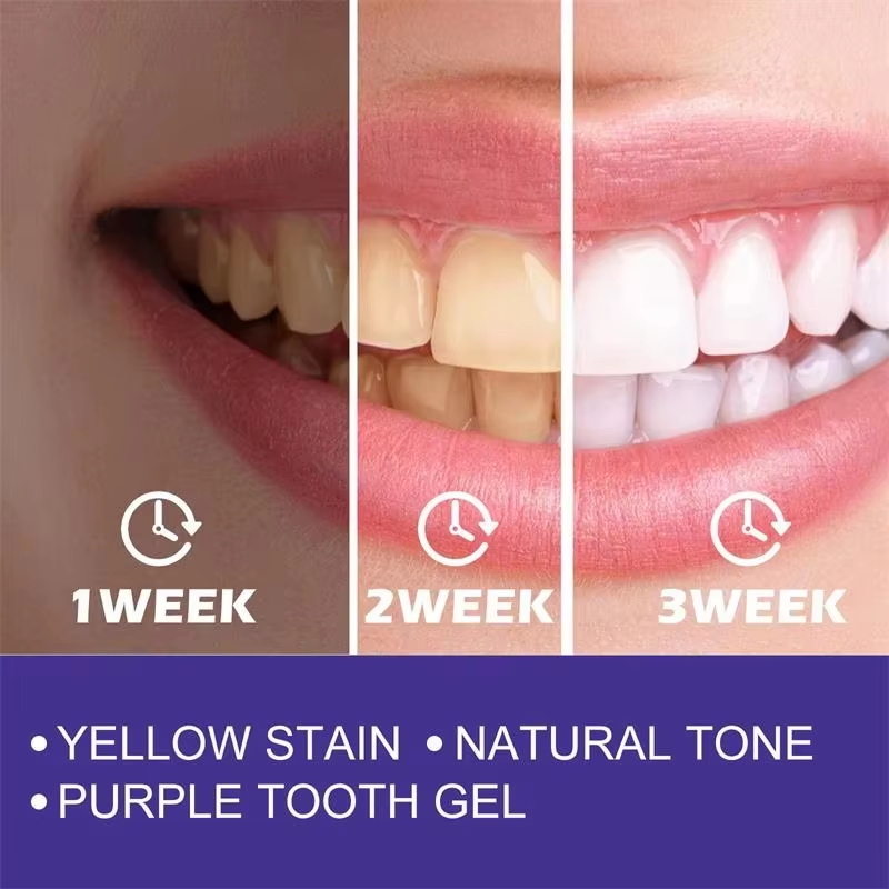 치아 미백 치약 화이트닝 젤 화이트너 표백제 얼룩 제거 - Teeth Whitening Korea 리뷰 및 가격