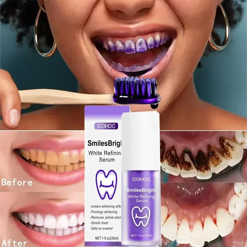 치아 세정 미백 치약 화이트닝 젤 미백제 얼룩 제거 상 - Teeth Whitening Korea 리뷰 및 가격