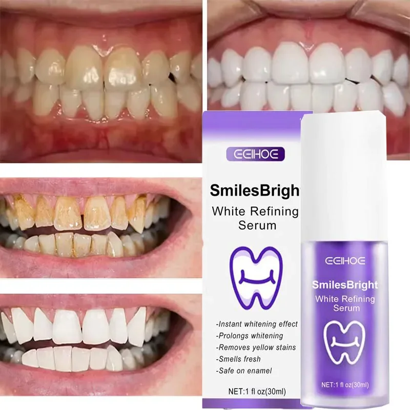 치아 세정 미백 치약 화이트닝 젤 미백제 얼룩 제거 상 - Teeth Whitening Korea 리뷰 및 가격