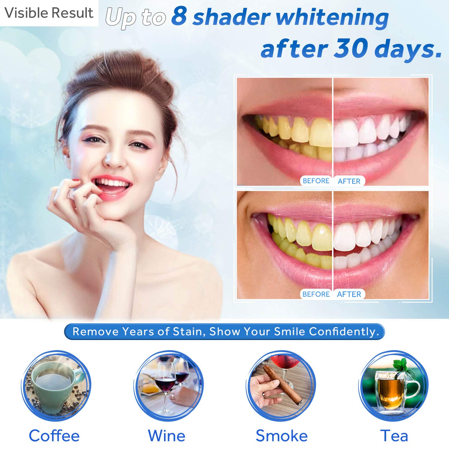 치아 미백 젤 리필 주사기 치아 미백 젤 인비스알라인  - Teeth Whitening Gel Peroxide 리뷰 및 가격