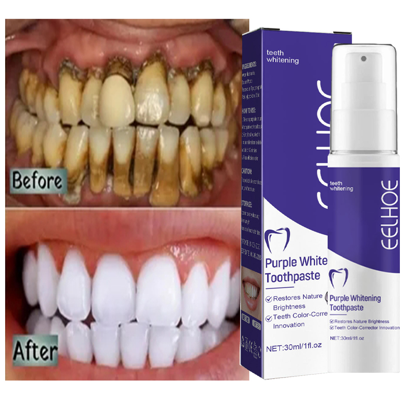 치아 클렌징 미백 치약, 미백 젤 표백제, 얼룩 제거, - Teeth Whitening Korea 리뷰 및 가격