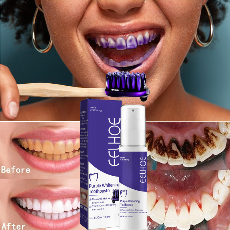 치아 클렌징 미백 치약, 미백 젤 표백제, 얼룩 제거, - Teeth Whitening Korea 리뷰 및 가격