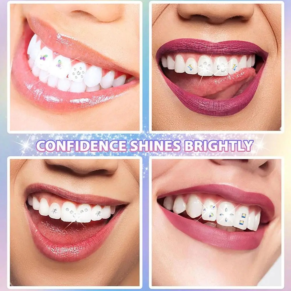 DIY 치아 보석 키트 투명한 보석 장식품 접착제와 라 - Tooth Gem Kit 리뷰 및 가격