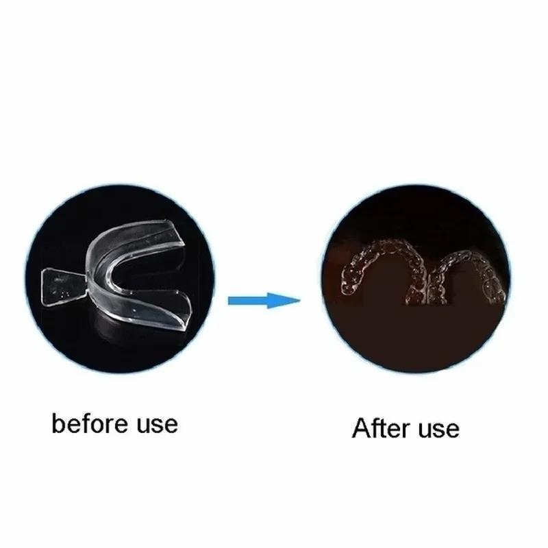 전문 치아 미백 트레이 치아 보호대 잇몸 치과 제품 치 - Teeth Whitening Opalescence 리뷰 및 가격
