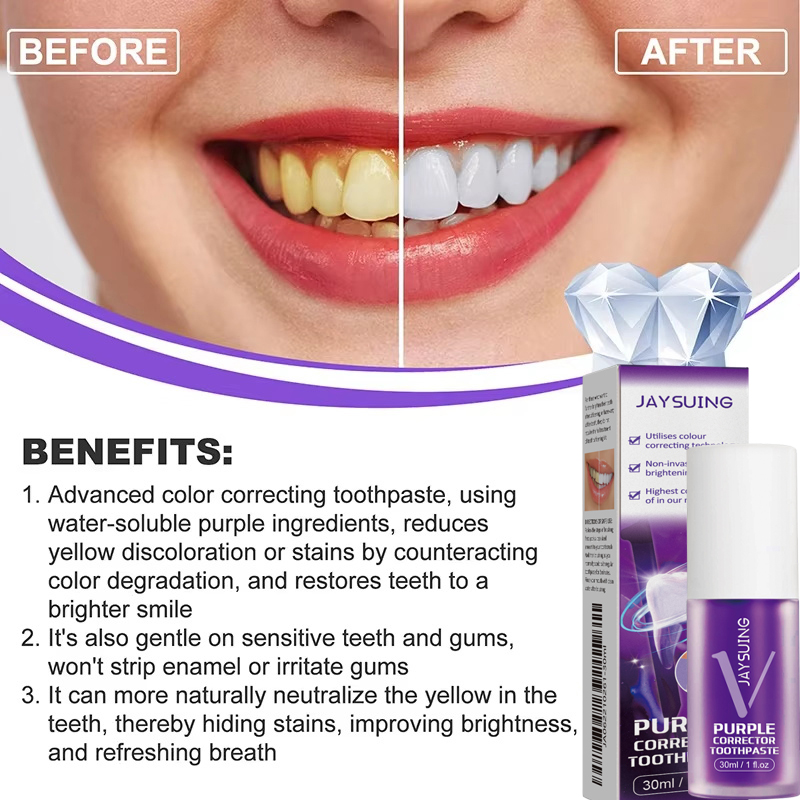 치아 미백 치약 화이트닝 젤 화이트너 표백제 얼룩 제거 - Teeth Whitening Korea 리뷰 및 가격