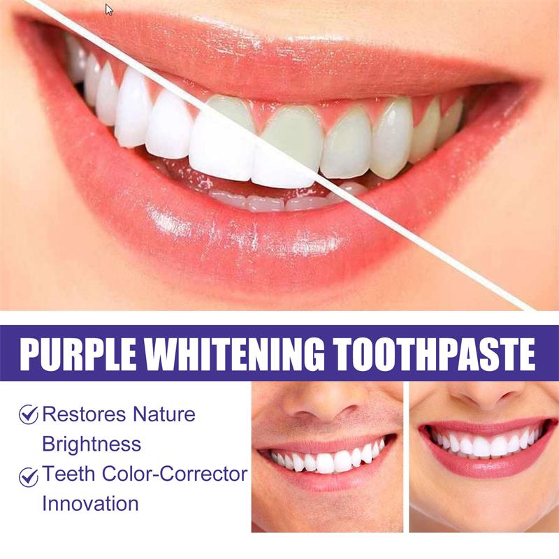 치아 미백 치약 화이트닝 젤 화이트너 표백제 얼룩 제거 - Teeth Whitening Korea 리뷰 및 가격
