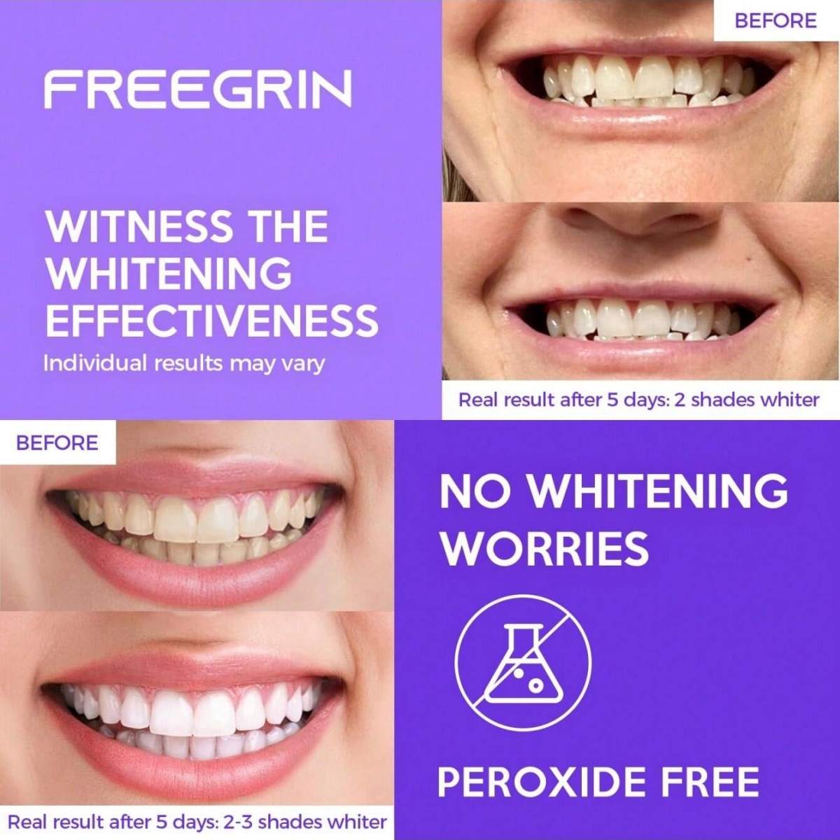 디럭스 화이트닝 치아 스티커 7/14/21 쌍 젤 화이 - Teeth Whitening Gel Peroxide 리뷰 및 가격