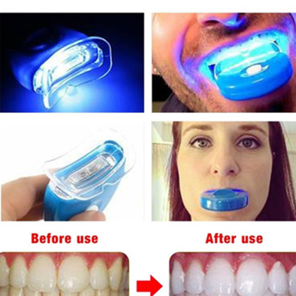 블루 LED 치아 미백 가속기, UV 라이트 치과 레이 - Teeth Whitening Uv Light 리뷰 및 가격