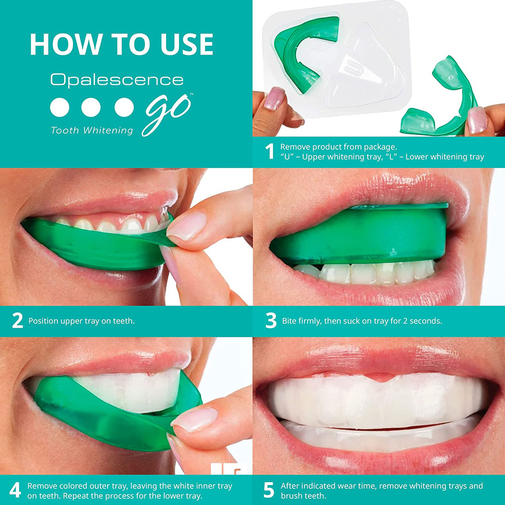 Opalescent Go 미백 트레이 3% PF 사전  - Teeth Whitening Opalescence 리뷰 및 가격