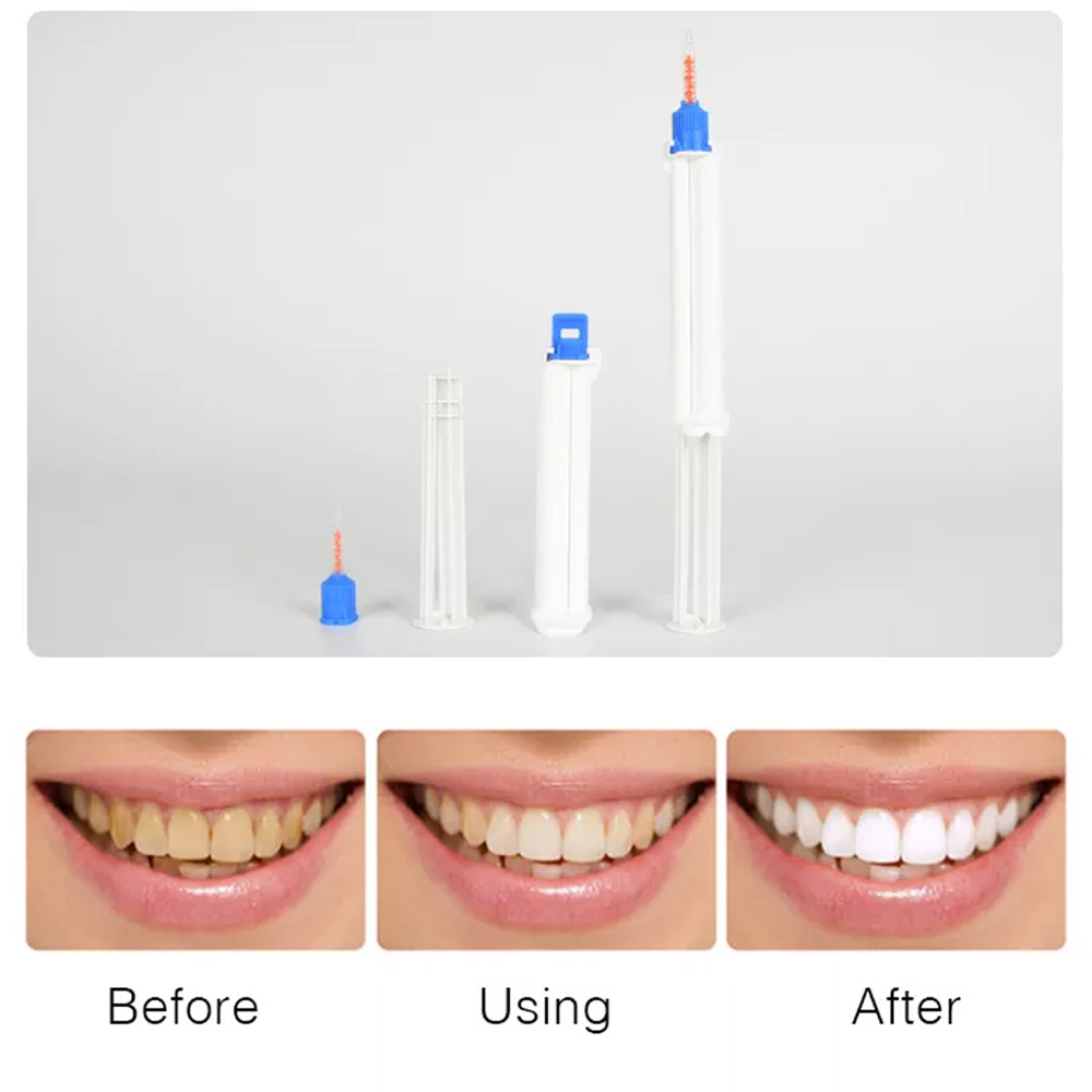 10/5/2개 치과용 듀얼 배럴 주사기 치아 미백 젤  - Teeth Whitening Opalescence 리뷰 및 가격