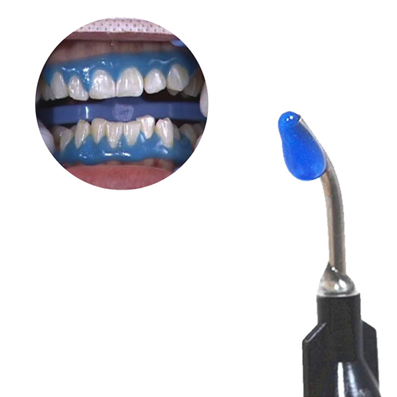 치아 미백 치은 장벽/치과 잇몸 댐 치아 미백 잇몸 보 - Teeth Whitening Opalescence 리뷰 및 가격