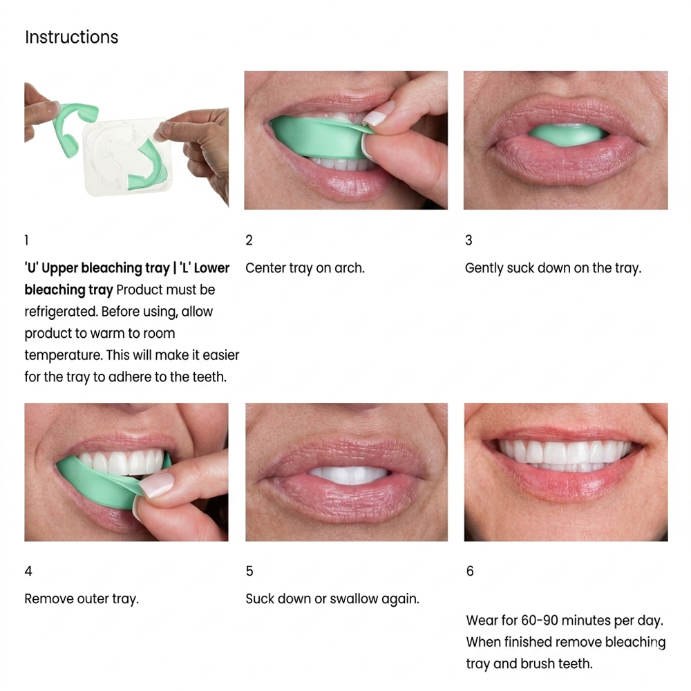 오팔레센스 GO 6% 과산화수소 프리필드 치아 미백 트 - Teeth Whitening Opalescence 리뷰 및 가격